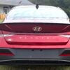 2025 HYUNDAI ELANTRA SEL SPORT 30 MIL MILLAS
